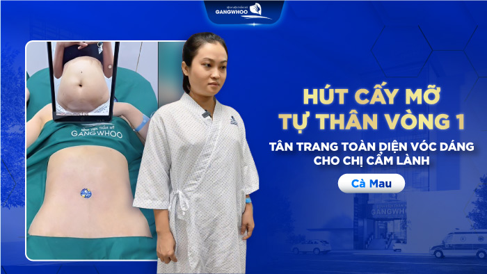 Hút cấy mỡ tự thân vòng 1 - tân trang toàn diện vóc dáng cho chị Cẩm Lành (Cà Mau) 5 Hút cấy mỡ tự thân vòng 1 - tân trang toàn diện vóc dáng cho chị Cẩm Lành (Cà Mau)