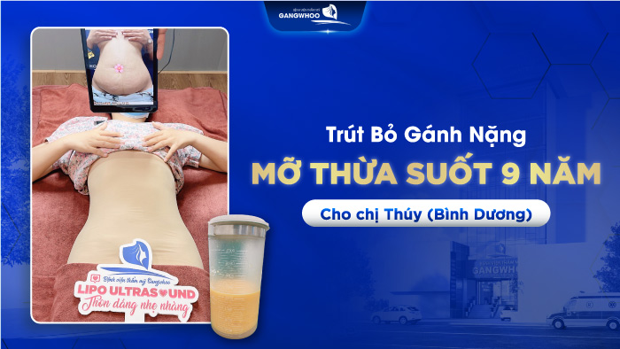 Chị Thúy (Bình Dương) sở hữu dáng đẹp như ý sau 60 hút mỡ Công nghệ cao (Lipo Ultrasound)