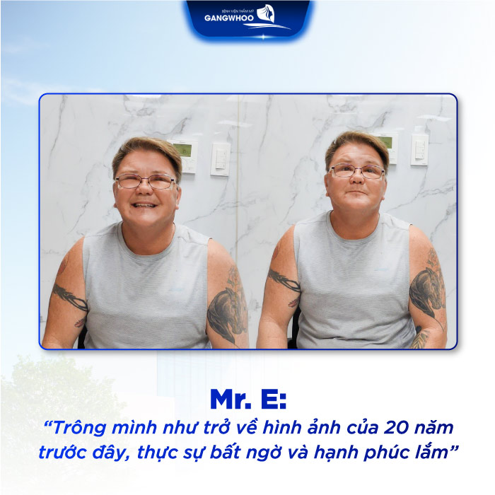 Lúc Đi Là Ông Ngoại - Khi Về Thành Anh Trai: Trẻ Hóa Thần Kỳ Cho Vị Khách Úc (Mr.E)