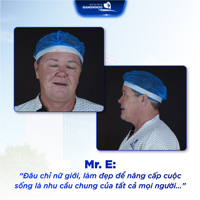 Lúc Đi Là Ông Ngoại - Khi Về Thành Anh Trai: Trẻ Hóa Thần Kỳ Cho Vị Khách Úc (Mr.E)