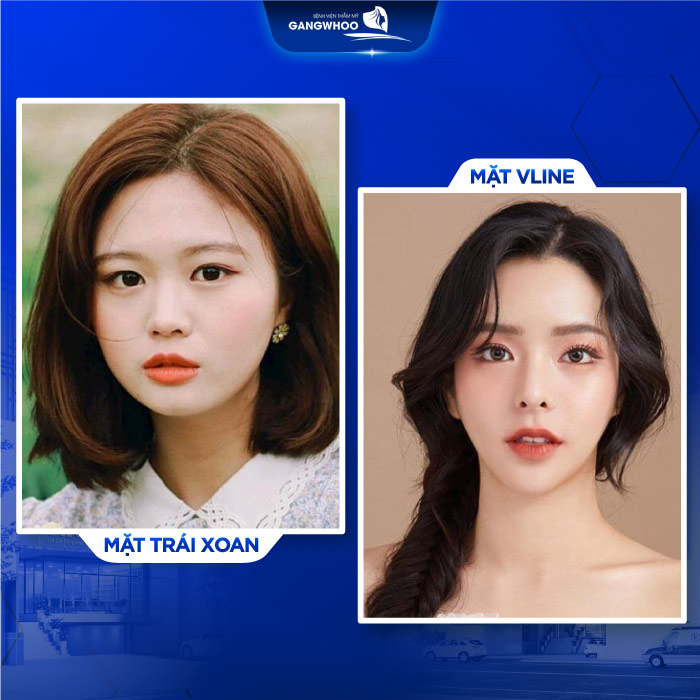 Gương mặt trái xoan