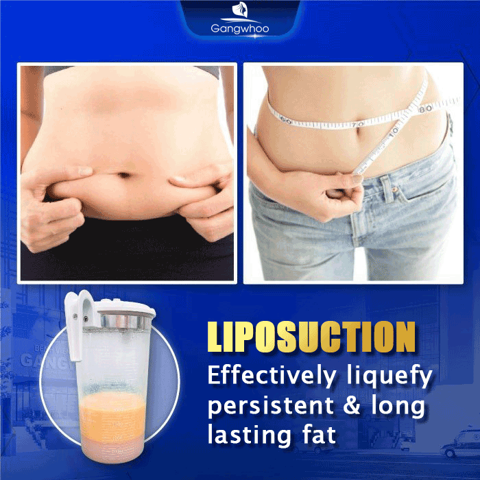 Liposuction or Lipotropic Injection