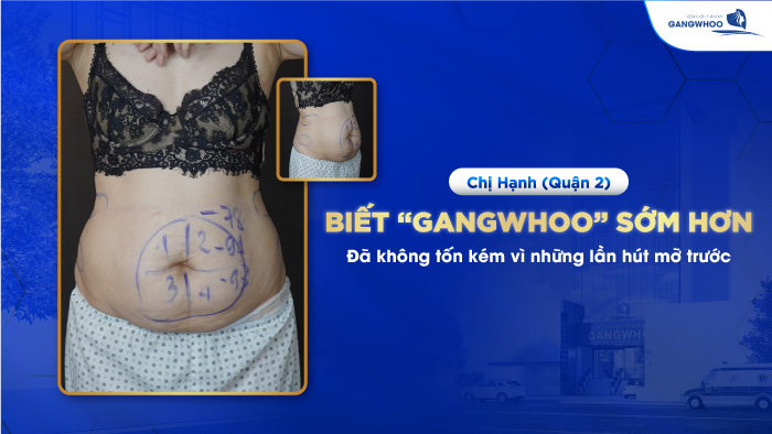 Chị Hạnh đỡ tốn kém khi biết đến Gangwhoo