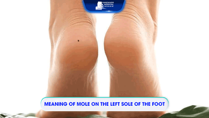 Discover the significance of people having moles on the soles of