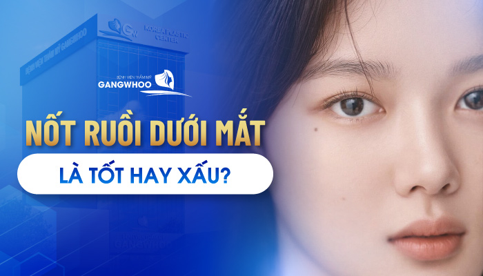 Nốt Ruồi Dưới Mắt “Tiết Lộ” Ý Nghĩa Gì Cho Nam Và Nữ 5 Nốt ruồi dưới mắt