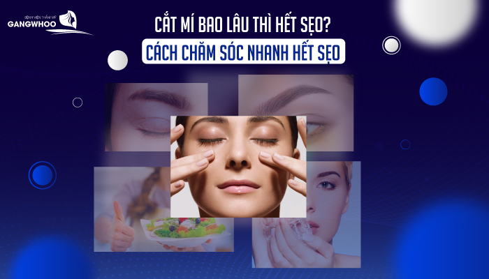 cat mi bao lau thi het seo