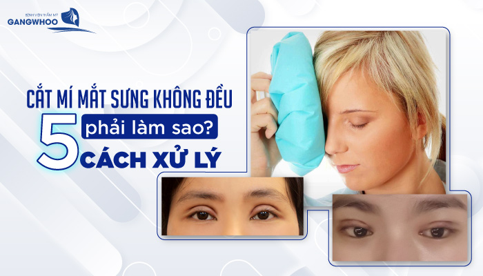 cat mi sung khong deu phai lam sao
