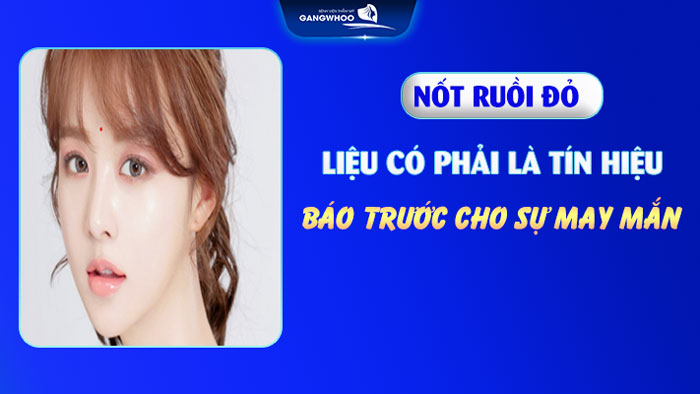 Nốt ruồi đỏ