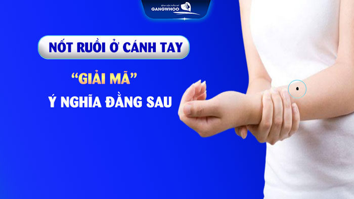 Nốt ruồi ở cánh tay