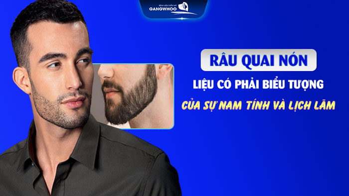 Râu quai nón
