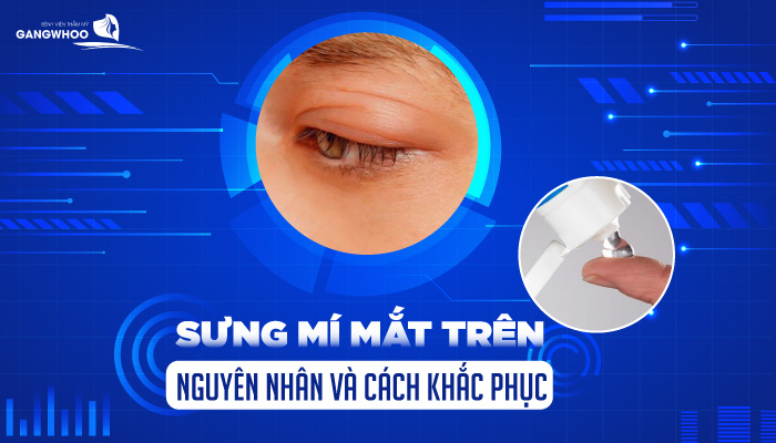 sung mi mat tren 1