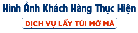 tex lay tui mo ma mobile