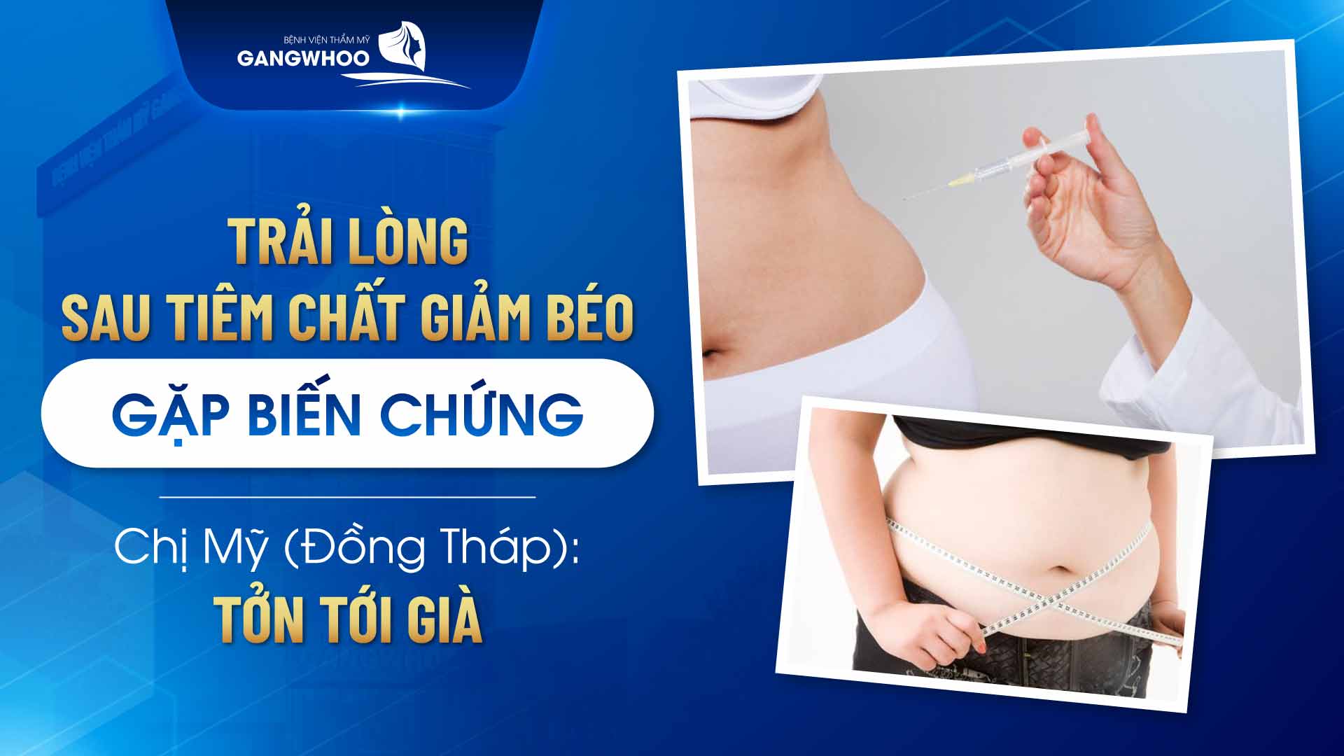 Trải Lòng Sau Tiêm Chất Giảm Béo Gặp Biến Chứng, Chị Mỹ (Đồng Tháp