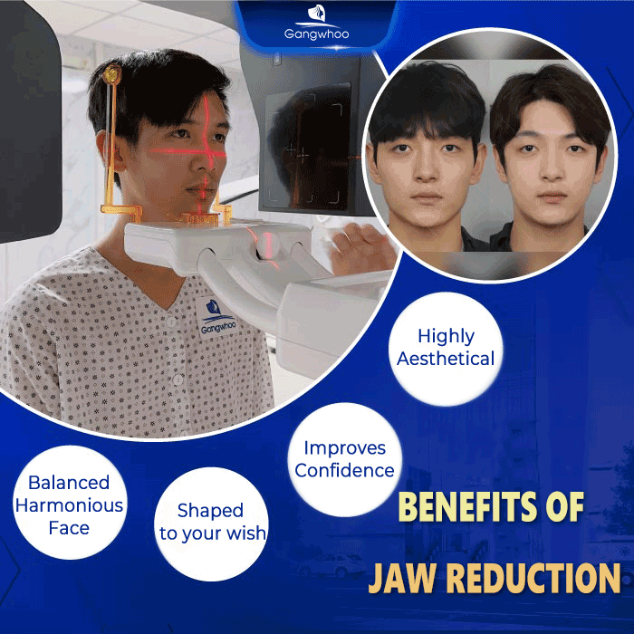 Benefits of jaw reduction