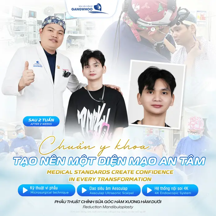 Gương mặt đẹp chuẩn thần thái tự tin gương mặt có điểm nhấn với quy trình chuẩn y khoa