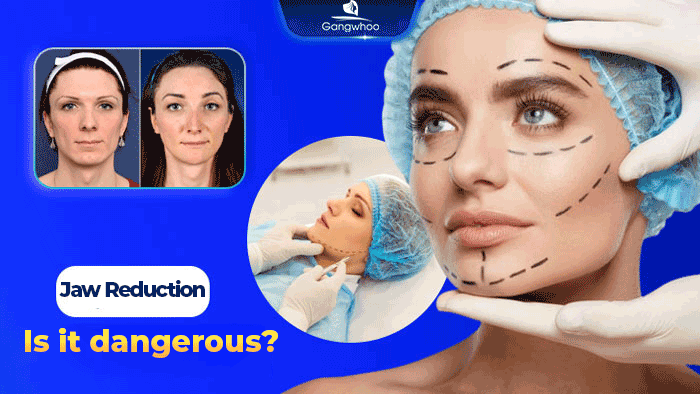 got ham co nguy hiem khong