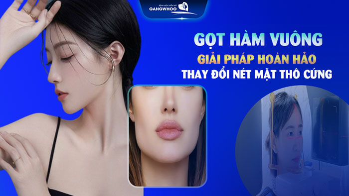Gọt hàm vuông
