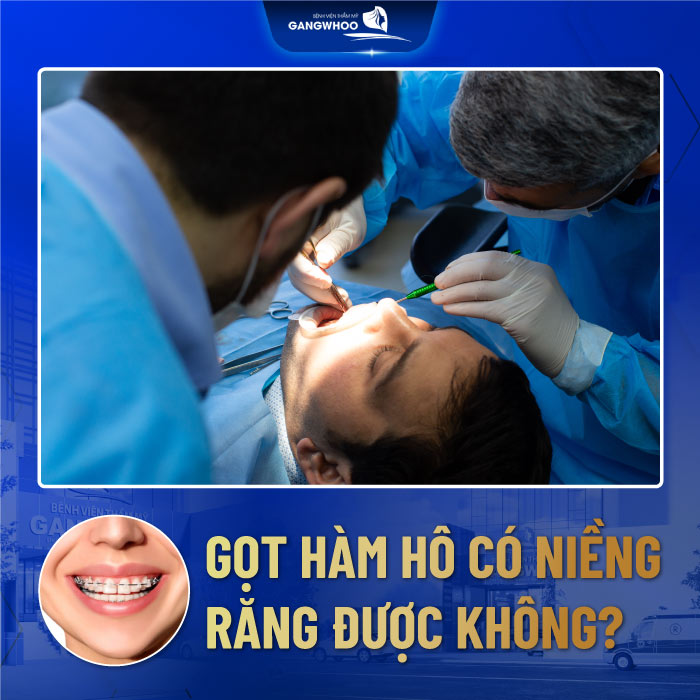 Gọt xương hàm hô