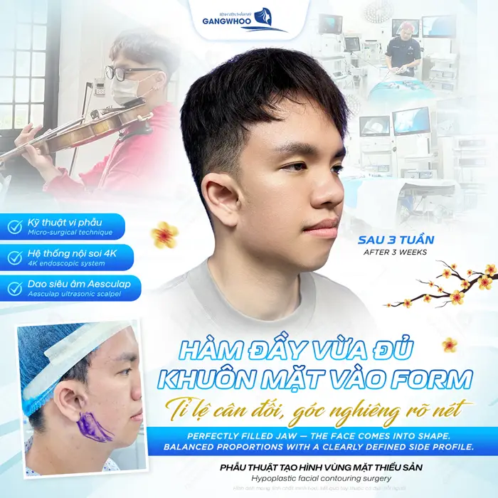 Hàm đầy vửa đủ khuôn mặt vào form tỉ lệ cân đối, góc nghiêng đẹp rõ nét