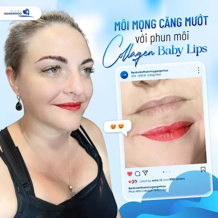 Phun Môi Là Gì? Khác Gì Xăm Môi? Top 9 Màu Hot 2025 2 Phun môi Collagen Baby Lips giải pháp lý tưởng cho bờ môi căng mướt dài lâu