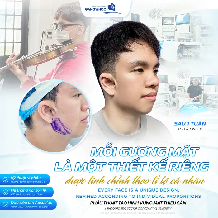 Mỗi gương mặt là 1 thiết kế riêng được tinh chỉnh theo tỉ lệ cá nhân sau 1 tuần đã khác biệt