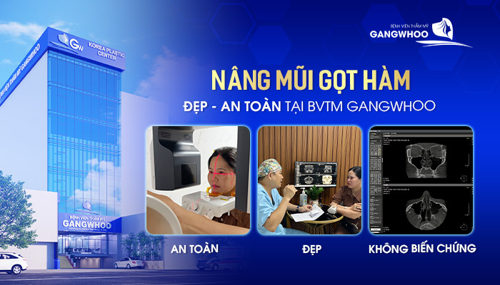 Nâng Mũi Gọt Hàm Thăng Hạng Nhan Sắc Với Gương Mặt Thanh Tú Thu Hút 9 Nâng mũi gọt hàm