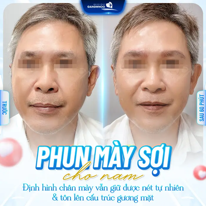 Phun mày sợi cho nam định hình đường chân mày đẹp chỉ sau 60 phút thực hiện