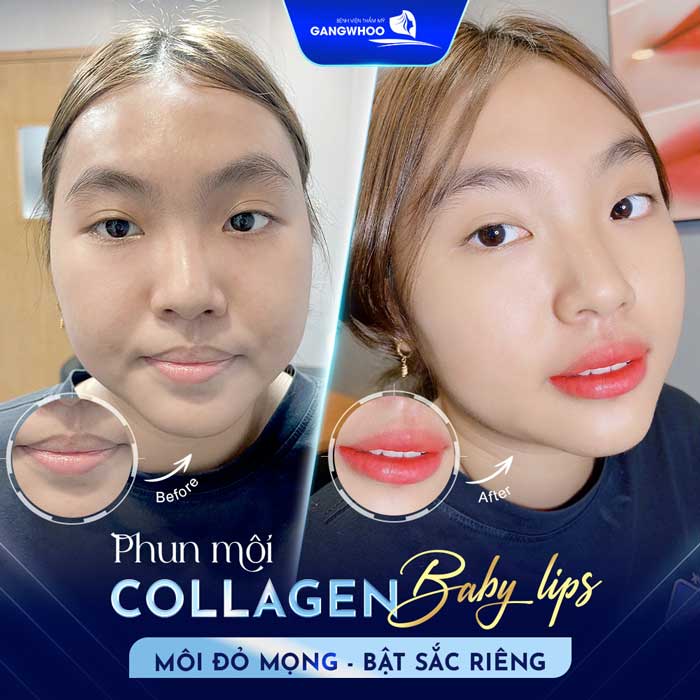 Phun Môi Là Gì? Khác Gì Xăm Môi? Top 9 Màu Hot 2025 10 Màu đỏ Ruby