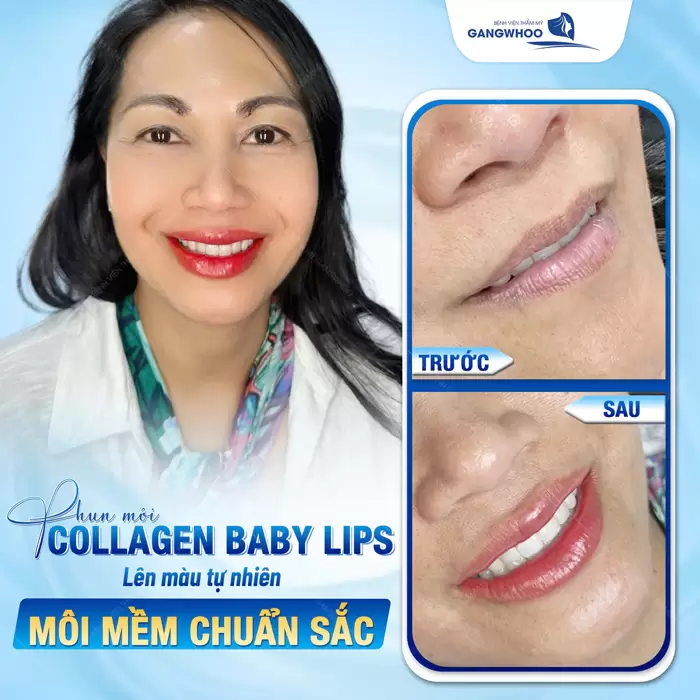 Phun Môi Là Gì? Khác Gì Xăm Môi? Top 9 Màu Hot 2025 8 Phun môi Collagen Baby Lips lên màu tự nhiên môi mềm chuẩn sắc đẹp hài hòa