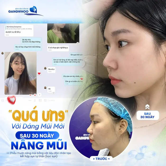dang mui moi sau 30 ngay nang mui dien mao thang hang ket qua sau 1 thang thuc hien