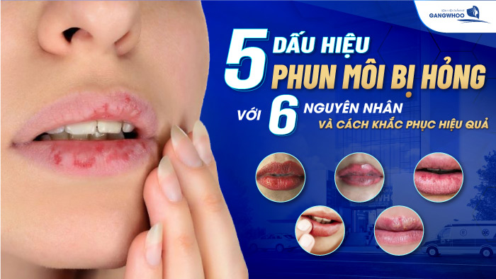 Dấu hiệu phun môi hỏng