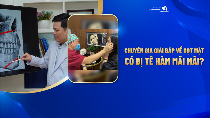 Gọt hàm có bị tê hàm mãi mãi