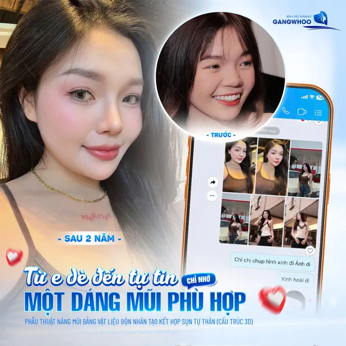 Từ e dè đến tự tin chỉ nhờ 1 dáng mũi mới phù hợp sau 2 năm thực hiện ngày càng xinh đẹp và tự tin hơn