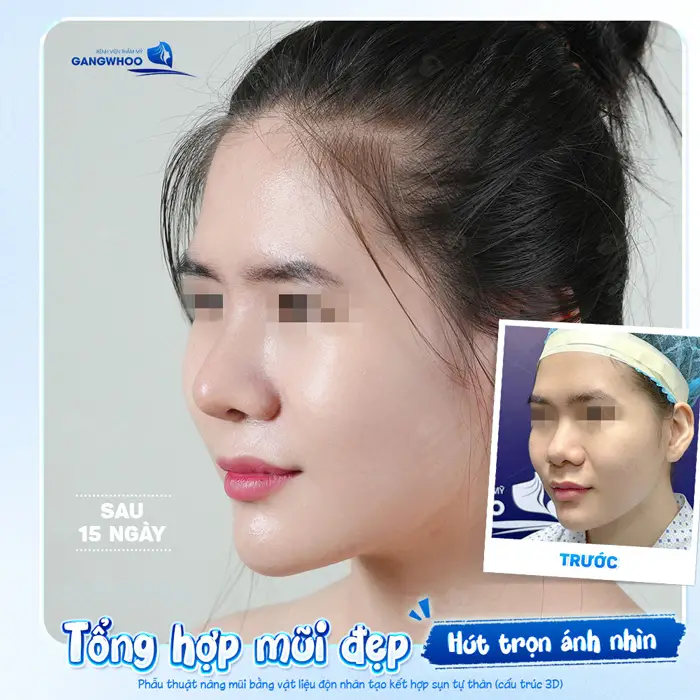 tong hop dang mui dep tai bvtm gangwhoo 2