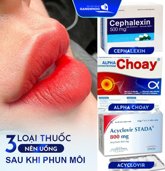 Phun Môi Có Phải Uống Thuốc Kháng Sinh Không? 3 Loại Thuốc Nên Uống 9 Phun Môi Có Phải Uống Thuốc Kháng Sinh Không