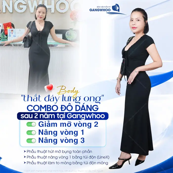 Hút Mỡ Bụng Có An Toàn Không? 5 Điều Cần Lưu Ý Khi Hút Mỡ 1 Body đẹp xuất sắc tự tin khoe thắt đáy lưng ong với sắc vóc cực nuột nà