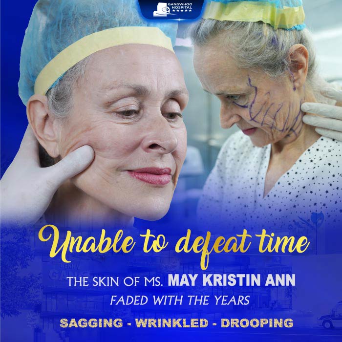 Nutritionist from New Zealand Visits Gangwhoo for a Facelift ‘Youthful’ Transformation and the Outcome 2 Gangwhoo