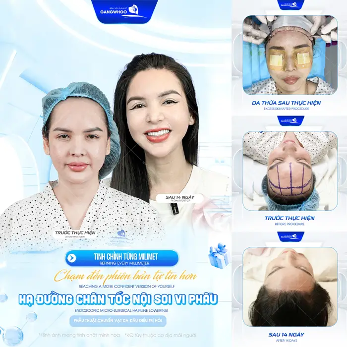 Gương mặt hài hòa bí quyết chạm đến phiên bản hoàn hảo và tự tin với gương mặt hài hòa đúng chuẩn tỷ lệ 