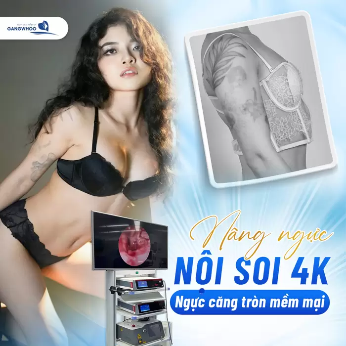 Công Nghệ Nội Soi 4K – Bước Tiến Đột Phá Trong Thẩm Mỹ Hiện Đại