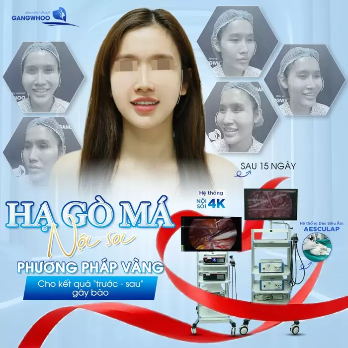 Công Nghệ Nội Soi 4K – Bước Tiến Đột Phá Trong Thẩm Mỹ Hiện Đại