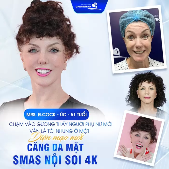 Công Nghệ Nội Soi 4K – Bước Tiến Đột Phá Trong Thẩm Mỹ Hiện Đại