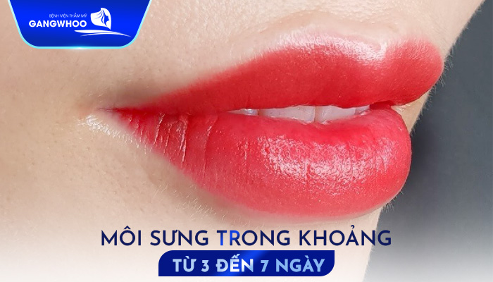 Phun Môi Có Phải Uống Thuốc Kháng Sinh Không? 3 Loại Thuốc Nên Uống 8 Phun Môi Có Phải Uống Thuốc Kháng Sinh Không