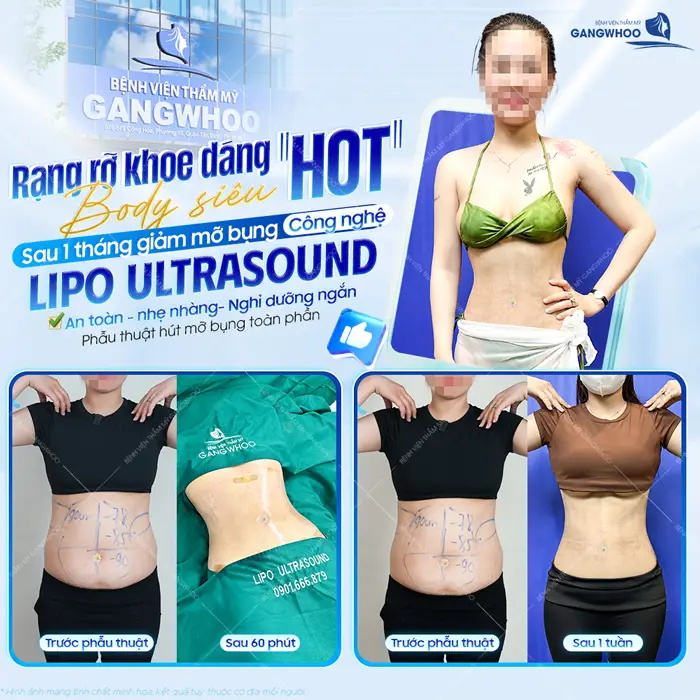 Rạng rỡ khoe dáng đẹp chuẩn với body đẹp siêu thực sau 1 tháng đã hoàn toàn khác biệt an toàn và hiệu quả thấy rõ