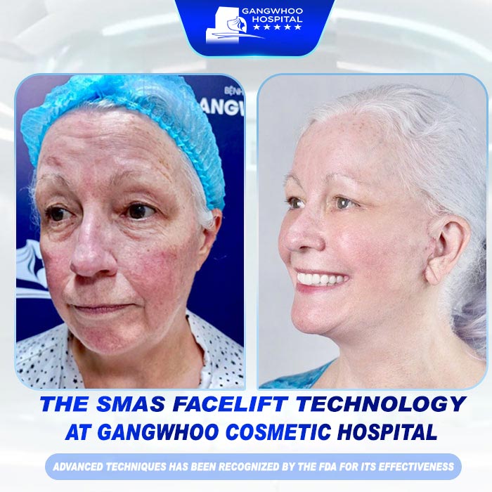 Ellen’s Spectacular Journey to Rediscover Her Youthful Glow at Gangwhoo 11 Youthful Glow at Gangwhoo