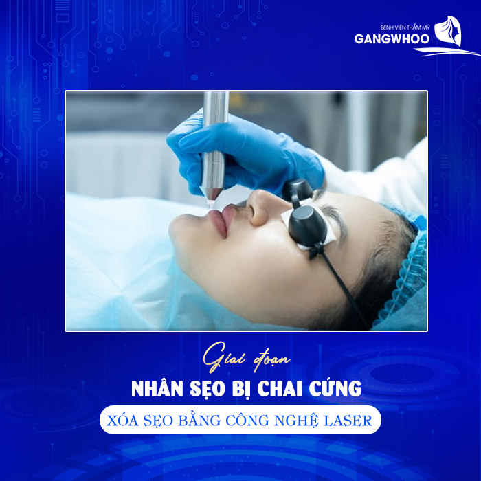 Phun Môi Bị Sẹo Phải Làm Sao? Tổng Hợp 4 Cách Trị Sẹo Nhanh Lành 10 Phun Môi Bị Sẹo Phải Làm Sao