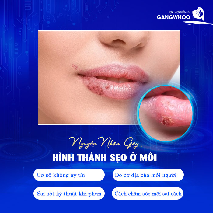 Phun Môi Bị Sẹo Phải Làm Sao? Tổng Hợp 4 Cách Trị Sẹo Nhanh Lành 7 Phun Môi Bị Sẹo Phải Làm Sao