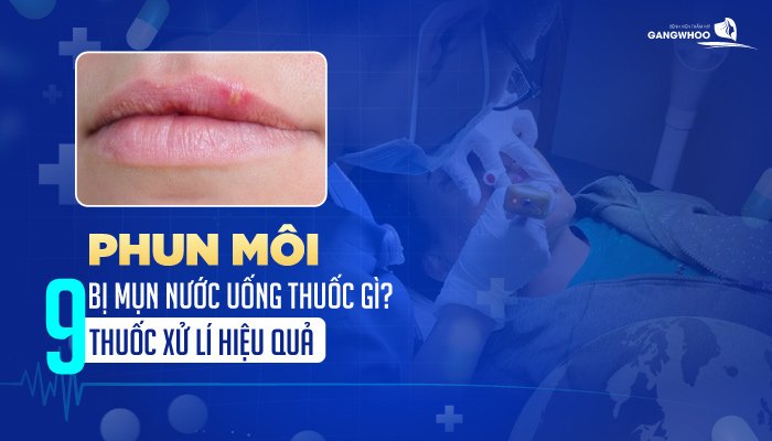 phun moi bi mun nuoc uong thuoc gi 1