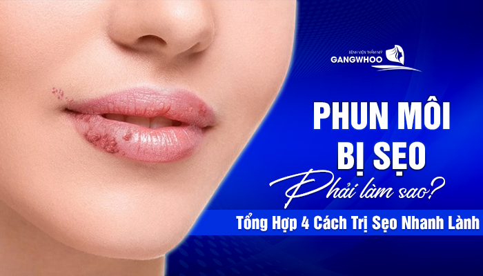 phun moi bi seo phai lam sao