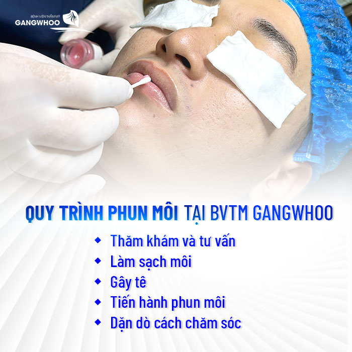Review 13 Địa Chỉ Khử Thâm Môi Ở TPHCM Uy Tín & Hiệu Quả 17 Địa Chỉ Khử Thâm Môi Ở TPHCM