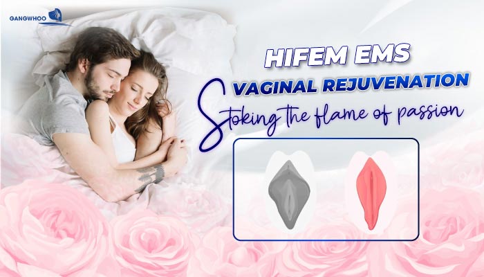 HIFEM EMS VAGINAL REJUVENATION - Stoking the flame of passion